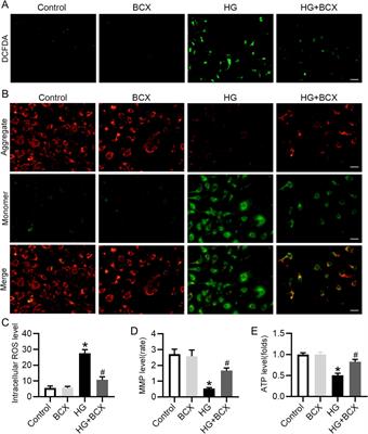 β-cryptoxanthin suppresses oxidative stress via activation of the Nrf2/HO-1 signaling pathway in diabetic kidney disease